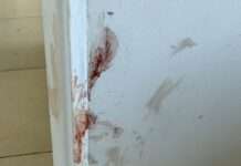 LA VECINA BRUTALMENTE GOLPEADA. DESCONOCIDOS ENTRARON A SU CASA A ROBAR